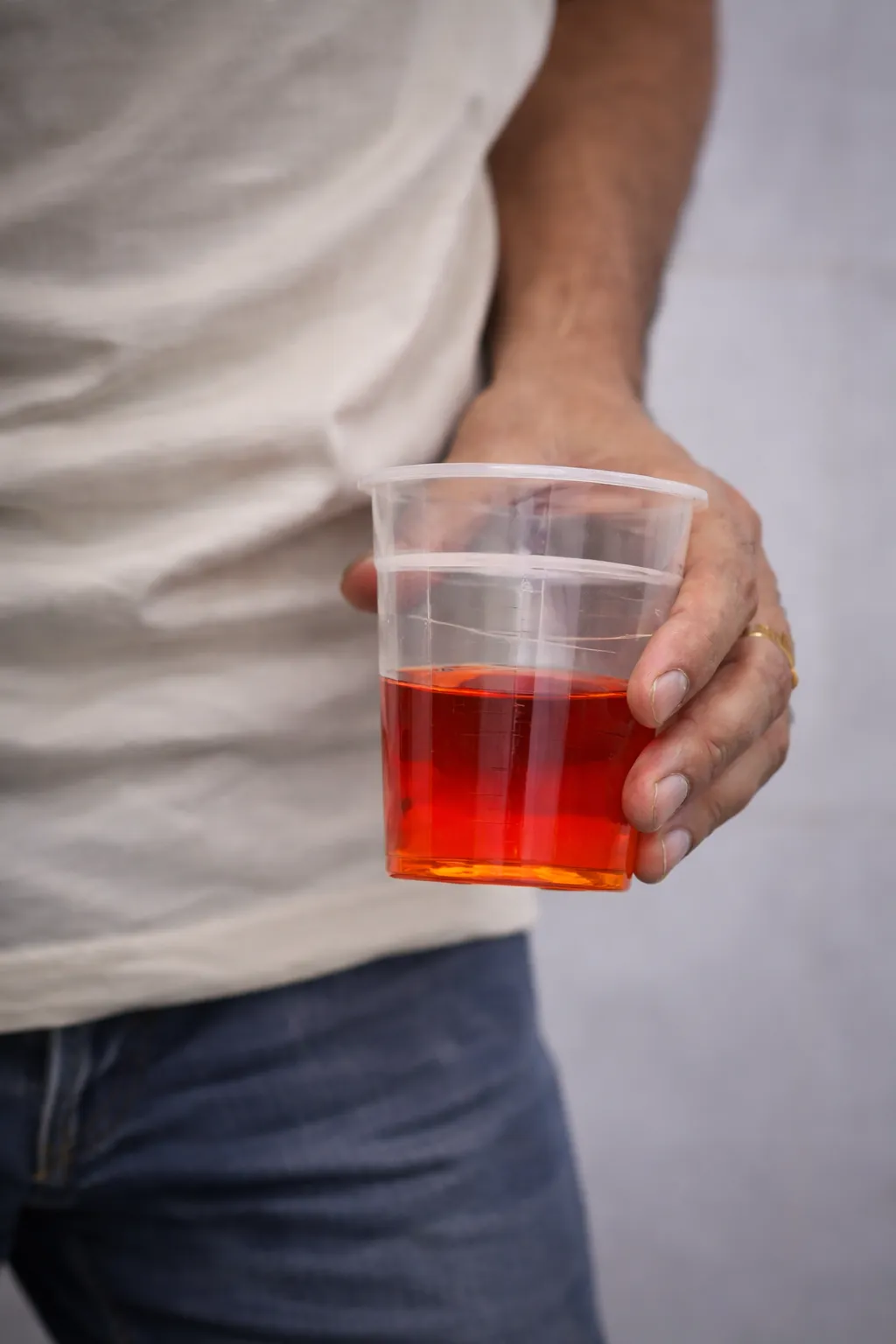 Blood in Urine (Haematuria)