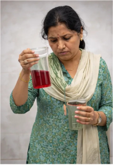 Haematuria with Stone on Scan