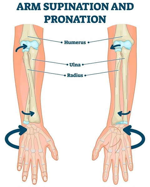 Loss of Forearm Rotation After Radius / Ulna Fracture