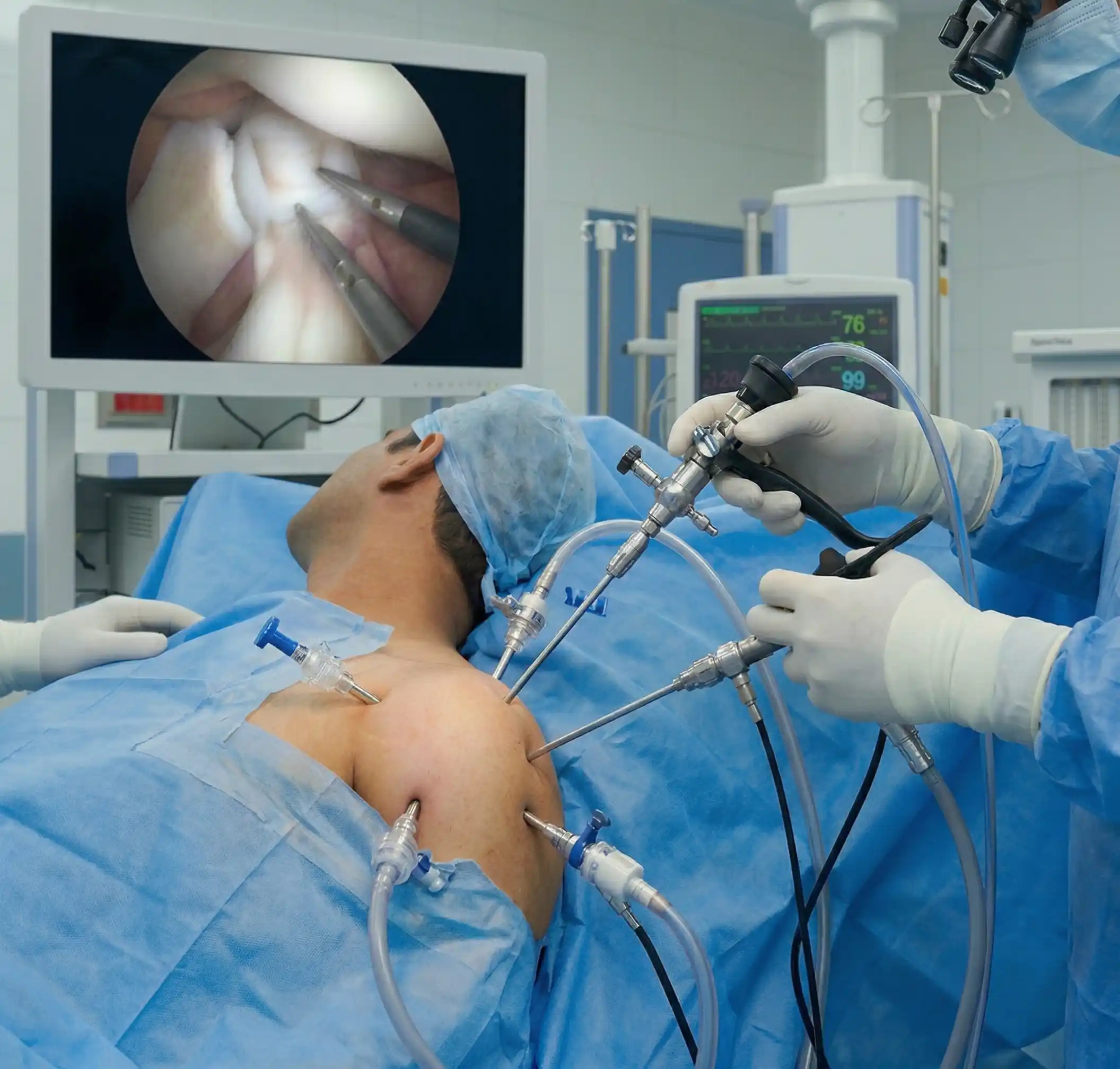 Shoulder Arthroscopy at Trayam Hospital