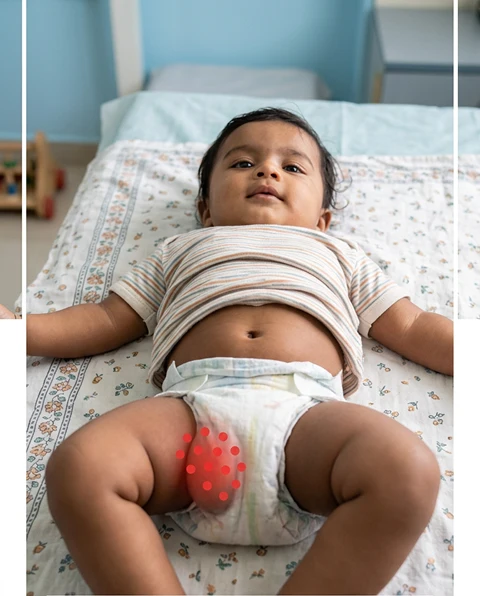 Persistent Bedwetting After Age 7